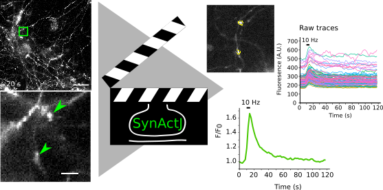 imagej fiji contrast plugin